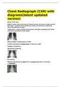 Chest Radiograph &lpar;CXR&rpar; with diagrams&lpar;latest updated version&rpar;&period;