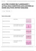 ACLS PRE-COURSE SELF-ASSESSMENT &sol; ACTUAL EXAM QUESTIONS AND ANSWERS &lpar;A&plus; GUIDE SOLUTION&rpar; NEWEST 2025&sol;2026