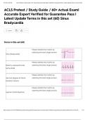 ACLS Pretest &sol; Study Guide &sol; 60&plus; Actual Exam&vert; Accurate Expert Verified for Guarantee Pass &vert; Latest Update Terms in this set &lpar;60&rpar; Sinus Bradycardia
