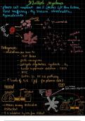 Exam &lpar;elaborations&rpar;  Multiple myeloma   Robbins 
