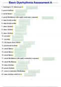 Basic Dysrhythmia Assessment A Exams Questions & Answers 100&percnt; Correct&excl;&excl; 2025&sol;2026