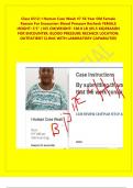 Class 6512&colon; I Human Case Week &num;7 56 Year Old Female Reason For Encounter&colon; Blood Pressure Recheck FEMALE HEIGHT&colon; 5&rsquo;5&rdquo; &lpar;165 CM&rpar;WEIGHT&colon; 188&period;0 LB &lpar;85&period;5 KG&rpar;REASON FOR ENCOUNTER&colon; BLOOD PRESSURE RECHECK LOCATION&colon; OUTPATIENT CLINIC WITH LABORATORY CAPABILITIES