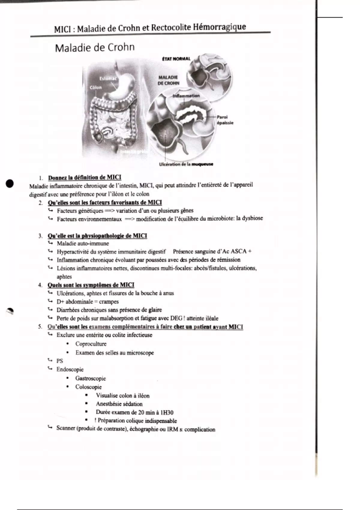 Résumé Fiche de révision Maladie de Crohn Définition, Symptômes — free download