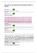 EKG Clep Test &lpar;50&rpar; Questions and Answers Verified&period; A&plus; Graded&period;