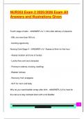 NUR353 Exam 2 2025&sol;2026 Exam All  Answers and Illustrations Given 