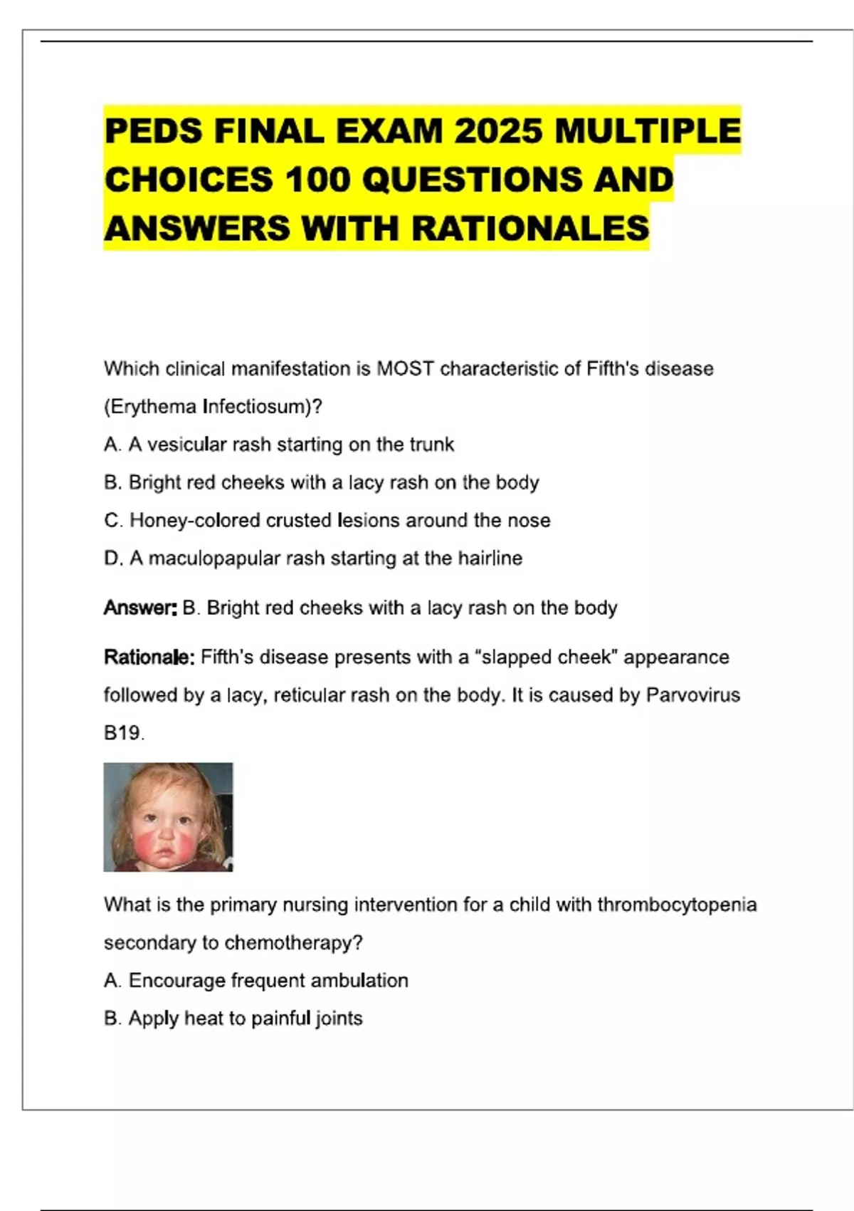 Peds R.pdf PEDS FINAL EXAM 2025 MULTIPLE CHOICES 100 QUESTIONS AND ANSWERS WITH ...