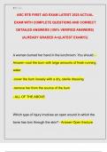 ARC RTE FIRST AID EXAM LATEST 2025 ACTUAL  EXAM WITH COMPLETE QUESTIONS AND CORRECT  DETAILED ANSWERS &lpar;100&percnt; VERIFIED ANSWERS&rpar;  &vert;ALREADY GRADED A&plus;&vert;&vert;LATEST EXAM&excl;&excl;&excl;&vert;&vert; 