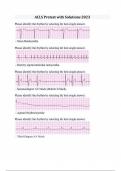 ACLS Pretest with Solutions 2025