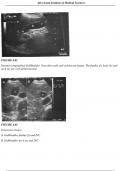 Radiologic Sciences & Medical Imaging &ndash; Gallbladder Ultrasound Case Guide &vert; NCLEX-Aligned Diagnostic Atlas PDF
