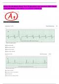 Relias Dysrhythmia Basic Test 35 Questions and Answers 2023 &lpar;Basic  A Dysrhythmia&rpar; GRADED A LATEST VERSION