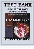 ECGs Made Easy &ndash; 6th Edition by Barbara Aehlert &ndash; Complete Test Bank &lpar;Chapters 1&ndash;10&rpar;