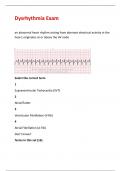 Dysrhythmia Exam