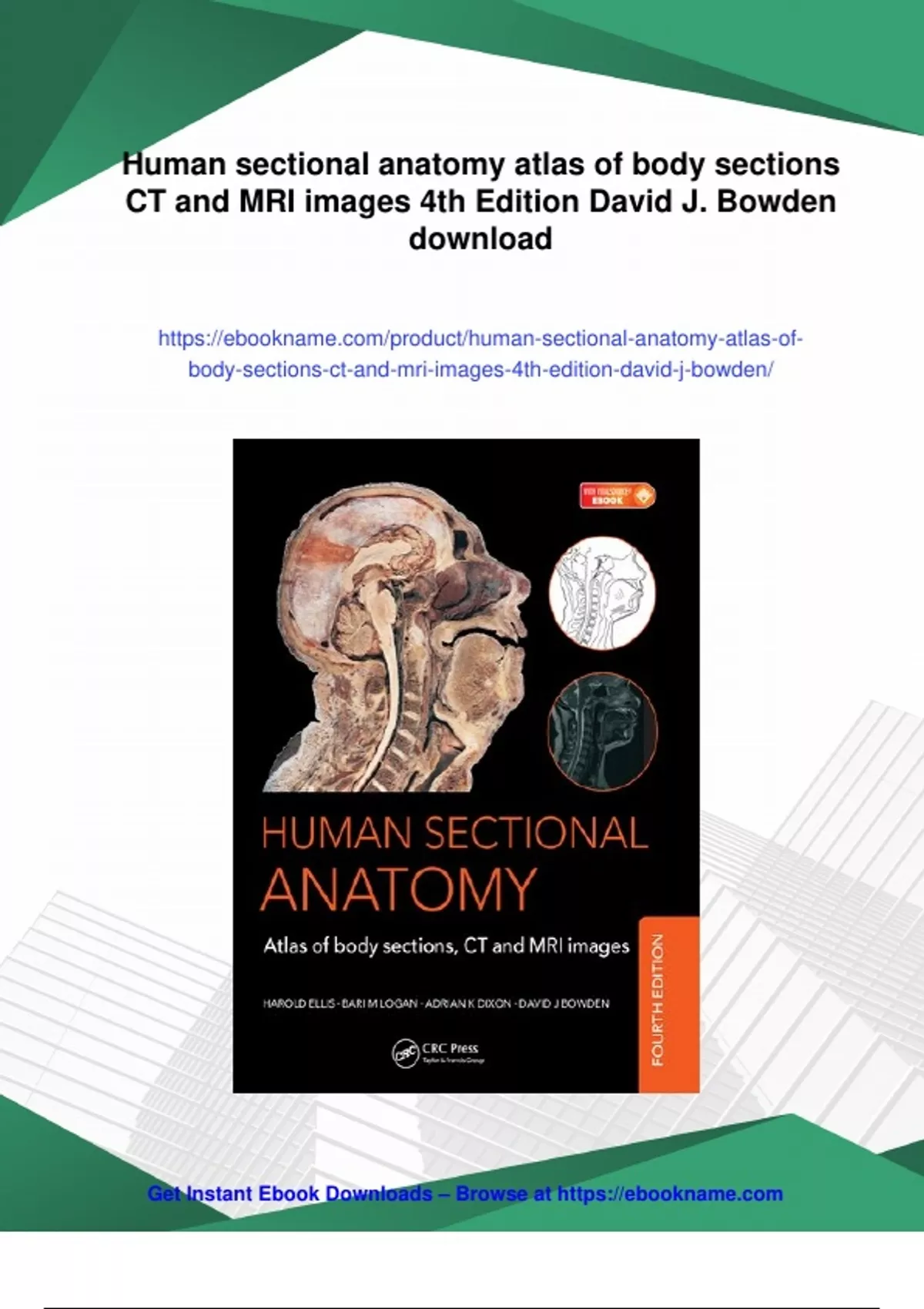Summary Human sectional anatomy atlas of body sections CT and MRI ...