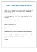 NSG 3009 exam 2 - visual problems