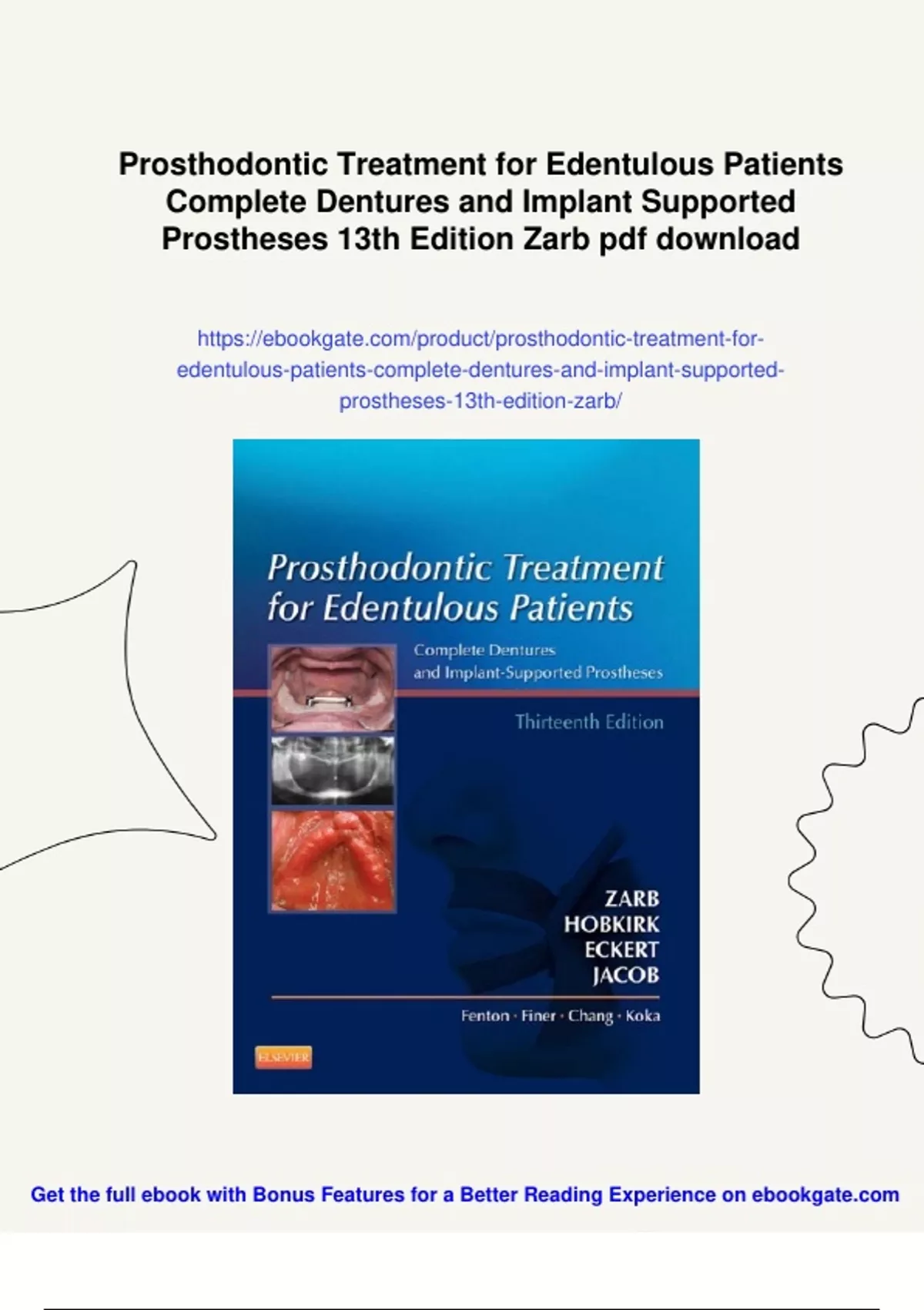 Summary Prosthodontic Treatment for Edentulous Patients Complete Dentures and Implant Supported ...