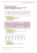  Dysrhythmias &ndash; Complete Exam with ECG Interpretation Questions and Verified Answers &lpar;Graded A&plus;&rpar;