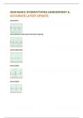 2025 BASIC DYSRHYTHMIA ASSESSMENT A&period; ACCURATE LATEST UPDATE&period;