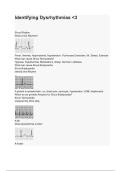 Identifying Dysrhythmias 3