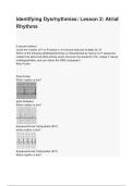 Identifying Dysrhythmias Lesson 2 Atrial Rhythms