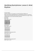 Identifying Dysrhythmias Lesson 2