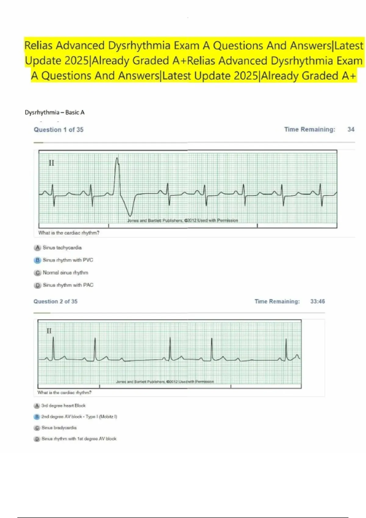 Relias Advanced Dysrhythmia Exam A Questions And Answers|Latest Update 2025|Already Graded A ...