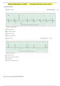 RELIAS ḌYSRHYTHMIAS PRACTICE QUESTIONS AND ACCURATE ANSWERS 2025&sol;2026