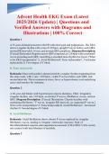 Advent Health EKG Exam &ndash; Latest 2025&sol;2026 Update &ndash; Verified Questions and Answers with Diagrams and Illustrations&comma; 100&percnt; Correct