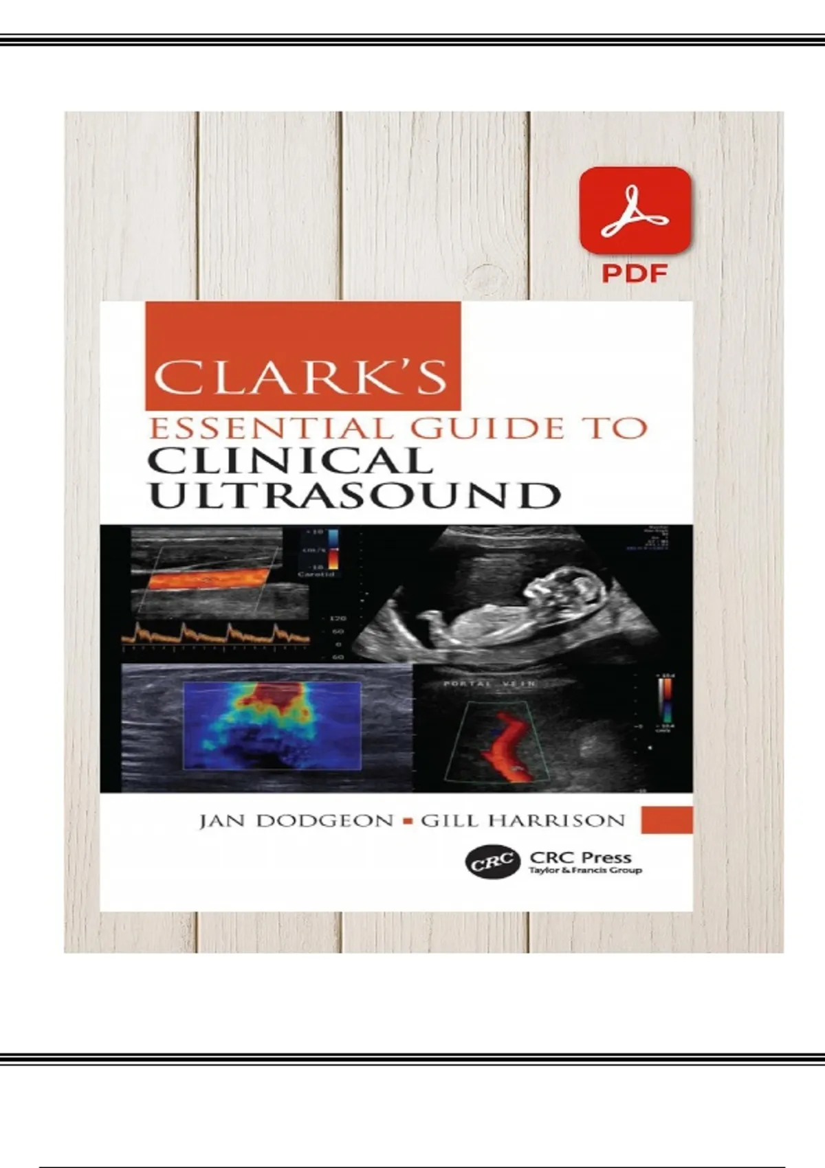 Clark’s Essential Guide to Clinical Ultrasound (2023) – Dodgeon ...