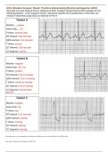 Practice EKG Interpretation ECG Student Answer Sheet & Review