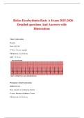 Relias Dysrhythmia Basic A Exam 2025 &vert; EKG Rhythm Interpretation Study Guide & Q&A