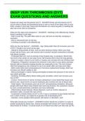 DEEP VEIN THROMBOSIS &lpar;DVT&rpar; EXAM QUESTIONS AND ANSWERS
