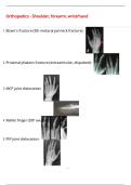 Orthopedics - Shoulder&comma; forearm&comma; wrist&sol;hand QUESTIONS AND CORRECT DETAILED  ANSWERS WITH COMPLETE SOLUTIONS  &vert; GRADED A&plus;
