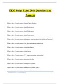 EKG Strips Exam 2026 Questions and Answers