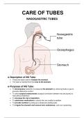 Care of Tubes &ndash; Nasogastric Tubes &lpar;Complete Nursing Study Material&rpar;