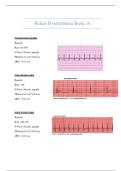 Relias Dysrhythmia Basic A &ndash; Complete Training PDF