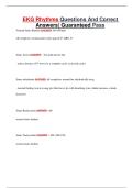 EKG Rhythms Questions And Correct Answers&vert; Updated&vert; Guaranteed Pass