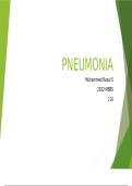 Pneumonia 