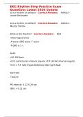 EKG Rhythm Strip Practice Exam Questions Latest 2026 Update&period;